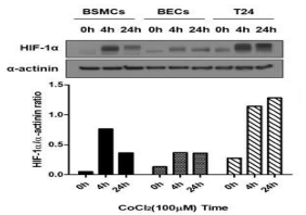 Confirmation of time-dependent Hif-1a induction in human bladder smooth muscle cells (BSMCs), bladder epithelial cells (BECs) and invasive bladder cancer cells (T24) treated with an inducer of Hif-1a CoCl2