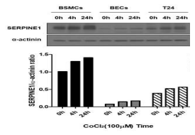 Confirmation of time-dependent Hif-1a –mediated SERPINE1 induction in human bladder smooth muscle cells (BSMCs), bladder epithelial cells (BECs) and invasive bladder cancer cells (T24) treated with an inducer of Hif-1a CoCl2