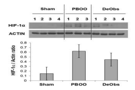 Hif-1a protein expression induced in bladder tissues of rat models. PBOO and DeObs groups showed significant higher expression levels of Hif-1a compared with the levels in Sham group
