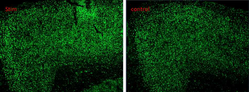 중뇌수도 주변 회백질 미세전기자극에 의한 EGR 변화