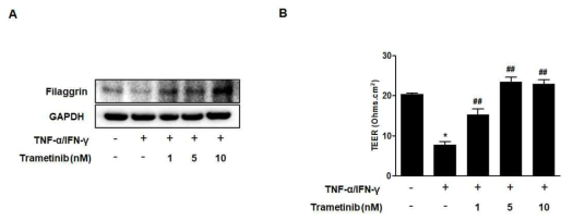 Trametinib의 filaggrin 증가 및 피부장벽기능 개선 효과