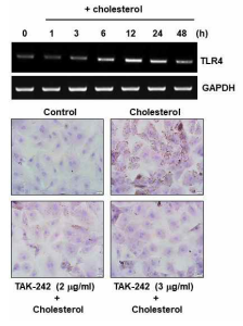 콜레스테롤에 의한 foam cell 형성에 관여하는 TLR4