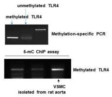 혈관평활근세포 TLR4 DNA 메틸화 분석