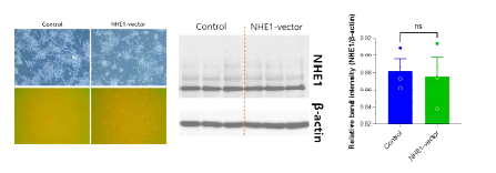 NHE1 over-expression vector의 in vitro 검 증