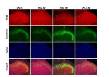 NHE1과 Calretinine 이중염색