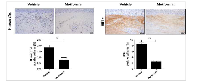 Metformin 투여 환자 모사 시스템 조직 분석 (IHC)