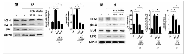 HIF-1α 신호 조절에 의한 켈로이드 섬유아 세포의 병적 자식작용 교정 및 염증성 세포 사멸/섬유화 조절