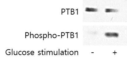 phosphorylated PTB1의 항체 제작 및 PTB1의 phosphorylation 확인. 시중에 PTB1 의 phosphorylation을 확인할 수 있는 antibody를 팔지 않기 때문에, 본 연구실에서 phospho-PTB1(활성형) 특이적 항체를 제작하여, Sirt6 결핍 마우스와 정상 마우스 사이에 glucose 자극 후 PTB1의 phosphorylation을 확인하였다. 15mM의 glucose 자극을 주었을 때 PTB1의 phosphorylation이 증가하여 activation 된 것을 확인할 수 있게 되었다.