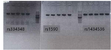 TGFBR1, BMPR1 PCR 결과 사진