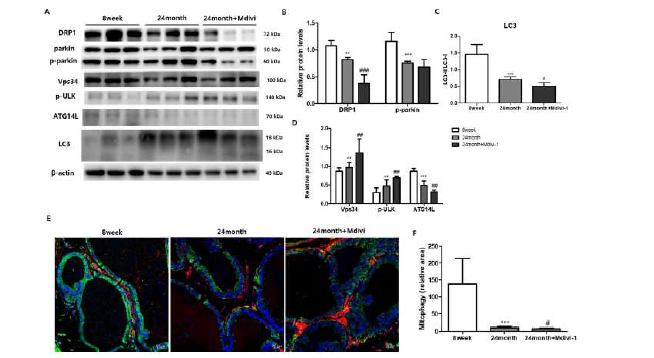 노령 동물에서 Mdivi-1처리 후 mitophagy관련 인자의 발현 변화