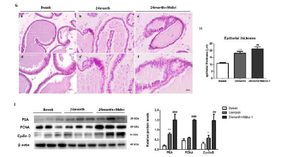 노령 동물에서 Mdivi-1처리 후 전립선 조직의 변화 및 전립선 비대 관련 인자의 발현 변화