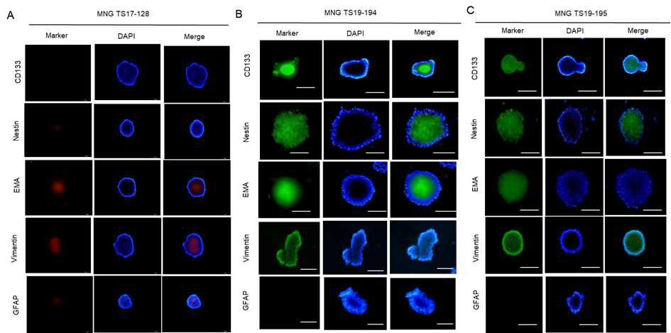 뇌수막종 종양구 세포를 이용한 면역세포화학법(Immunocytochemistry)를 통한 특성 확인