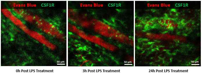 실시간 생체현미경을 활용한 비 고전적 단핵구에서 발현되는 CX3CR1의 프 로모터를 통해 GFP를 발현시켜 단핵구를 형광 표지한 유전자 변형 마우스 조직 주 변 혈관 내 단핵구의 움직임 정량