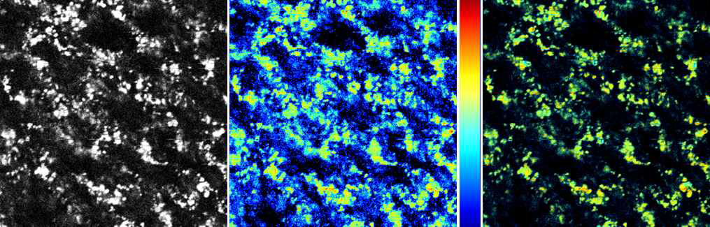 쥐 폐 조직의 two-photon ch.1 자가형광 영상 (좌: intensity, 중앙: FLIM 우: intensity-weighted FLIM)