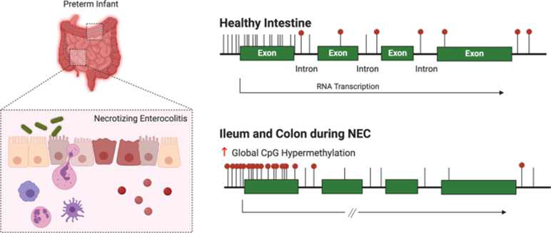 Global hypermethylation of intestinal epithelial cells as a hallmark feature of neonatal surgical necrotizing enterocolitis