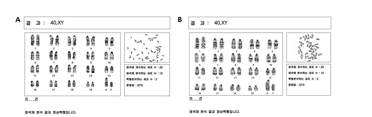 유도생식선줄기세포 핵형 (A)과 생식선줄기세포의 핵형 (B)분석 결과
