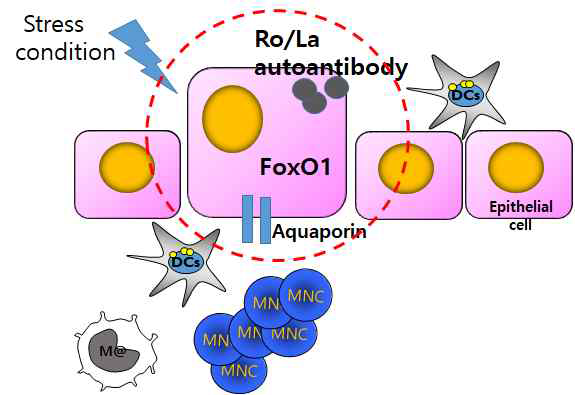 FoxO1과 Aquaporin