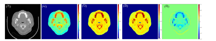 Dual-layer DECT를 이용하여 획득한 환자 영상; (가) 120 kVp CT 영상 (나) 유효원자번호 영상 (다) 전자밀도 영상 (라) 하전입자 저지능(SPR) 영상 (마) SECT 방법론과 DECT 방법론의 SPR 차이 영상