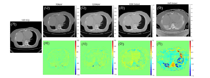 딥러닝 학습을 통해 생성한 파라메트릭 맵; (가) 120 kVp (Input) (나) 70 keV VMI (다) 120 keV VMI (라) 유효원자번호 (마) 전자밀도 (바) Philips 제공 70 keV VMI와 생성한 VMI의 차이 맵 (사) Philips 제공 120 keV VMI와 생성한 VMI의 차이 맵 (아) Philips 제공 유효원자번호와 생성한 유효원자번호의 차이 맵 (자) Philips 제공 전자밀도와 생성한 전자밀도의 차이 맵