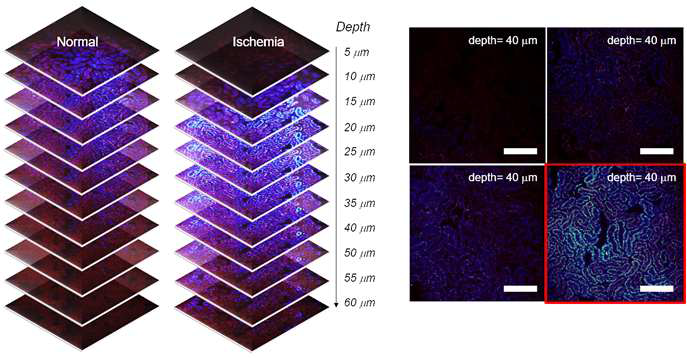 신장 허혈 재관류 모델에서 NPO-B를 이용한 Two-photon microscopy tissue imaging