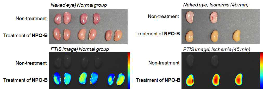 허혈 재관류 손상 마우스 신장을 적출하여 NPO-B에 incubation 후 관찰한 FTIS image