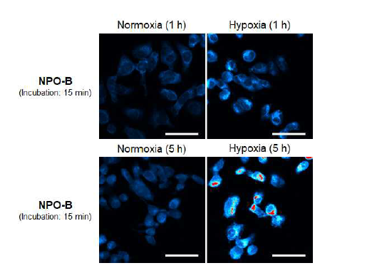 In vitro HK2 cell의 허혈/재관류 모델에서 Hypoxia 시간에 따른 NPO-B circulation 후 FTIS image