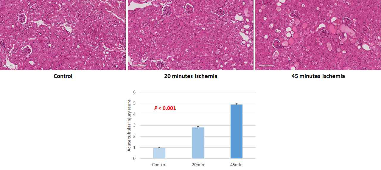 신장 허혈 재관류 모델에서 H&E staining