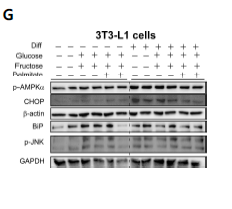 3T3-L1 세포에서 Glu, Frc, PA 처치가 지방분화, 염증 및 ER stress 기전에 미치는 영향