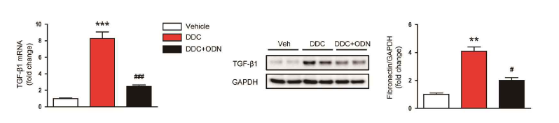 TGF-β1/NF-kB ODN에 antisense effect