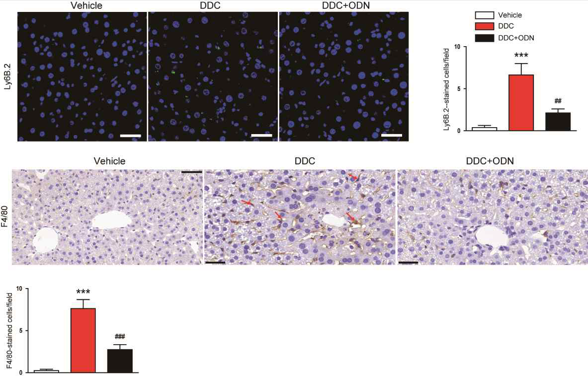 TGF-β1/NF-kB ODN에 의한 neutrophil, macrophage 감소