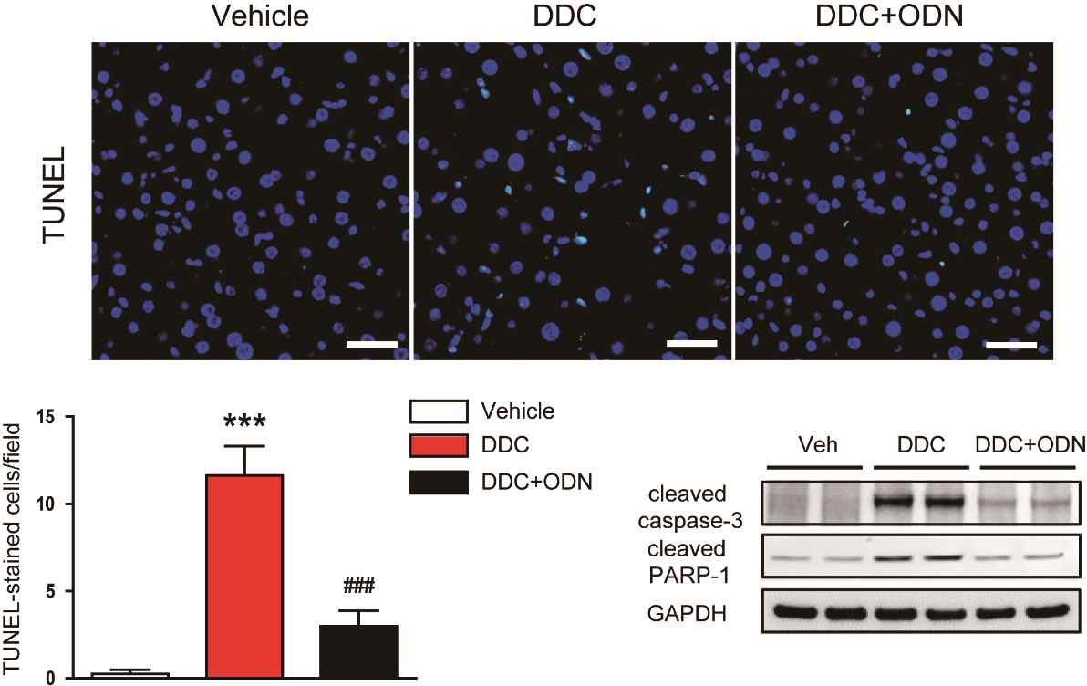 TGF-β1/NF-kB ODN에 의한 apoptosis 감소