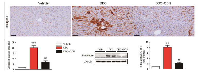 TGF-β1/NF-kB ODN에 의한 ECM protein 감소