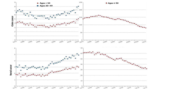 연령에 따른 대장암 발생률의 변화, 미국 SEER data