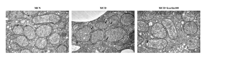 Effects of icariin supplementation on mitochondrial morphology using TEM in NASH mice