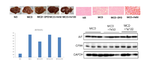 Effects of iron loading on the development of NASH in mice fed methionine/choline deficient (MCD) diet