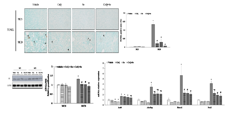 Effects of CoQ and Selenium supplementation on the ferroptotic markers in the liver tissues of NASH mice fed MCD diet (upper) Representative TUNEL staining sections (middle) AIF protein levels (lower) mRNA levels of genes related to ferroptosis