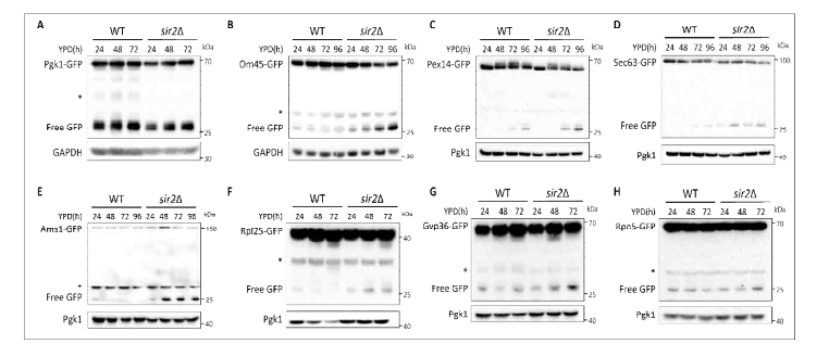 Sir2 결손에 의한 selective autophagy 증가 현상 분석