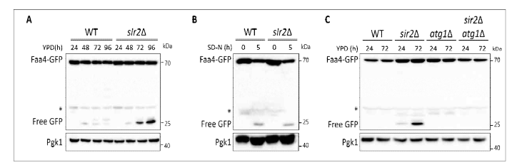 Sir2 결손에 의한 Microautophagy (lipophagy) 증가 현상 관찰