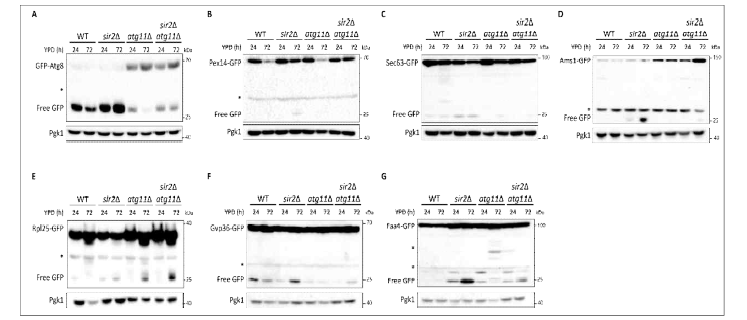 Sir2 결손에 의한 autophagy 증가와 Atg11 관계 분석