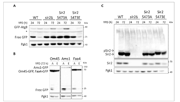 Sir2 S473 잔기 인산화가 autophagy에 미치는 영향 분석