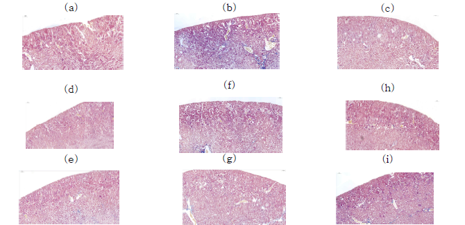 MGO 경구투여로 유도된 신장 섬유화(fibrosis)에 대한 해양생물자원 추출물의 예방효과: 대조군 (a), 300 mg/kg MGO (b), 60 mg/kg AG (c), 감태 50 mg/kg (d), 감태 200 mg/kg (e), 패 50 mg/kg (f), 패 200 mg/kg (g), 넓패 50 mg/kg (h), 넓패 200 mg/kg (i)