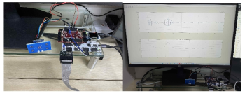 FPGA prototyped SoC equipped to radar sensor board