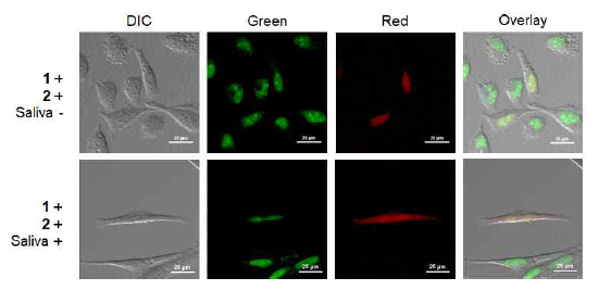 라이브 세포를 이용한 타액 내 cortisol 검출