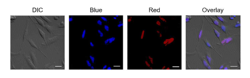 형광현미경으로 확인한 stable sensorcell line