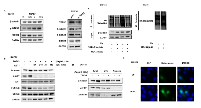 TGFβ2 신호전달에 의한 GSK3β/β-catenin 활성화 기전