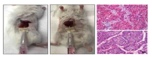 TGF-β2 발현이 높은 간암 세포주를 활용한 orthotopic 동물 모델 제작 및 macrotrabecular HCC 조직 특성 확인