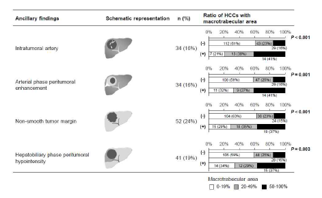 동맥기 조영 증강 패턴 이외에 macrotrabecular area와 연관된 MRI 영상 소견