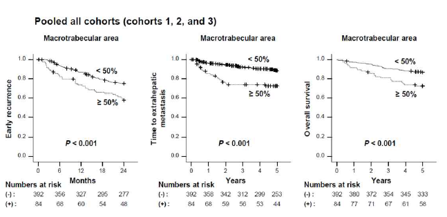 Macrotrabecular area에 따른 예후 (조기 재발, 간외 전이, 생존기간) 비교 분석