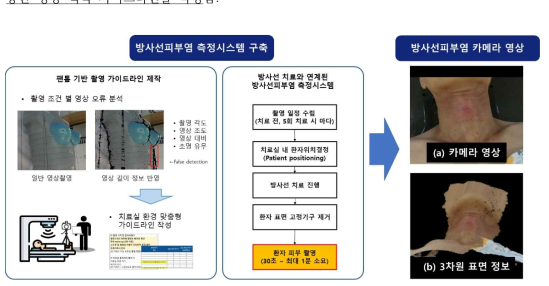 카메라 기반 방사선피부염 측정시스템 워크플로우 및 영상획득 예시