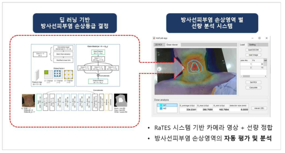 딥 러닝 기반 방사선피부염 segmentation 과정 및 피부선량 분석 시스템의 유저 인터페이스